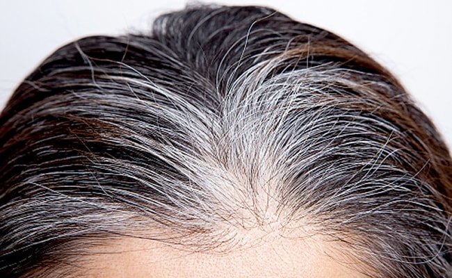 Flaxseed for White Hair: Natural Remedy for Safed Balo Ko Kala Karne Ka Gharelu Upay