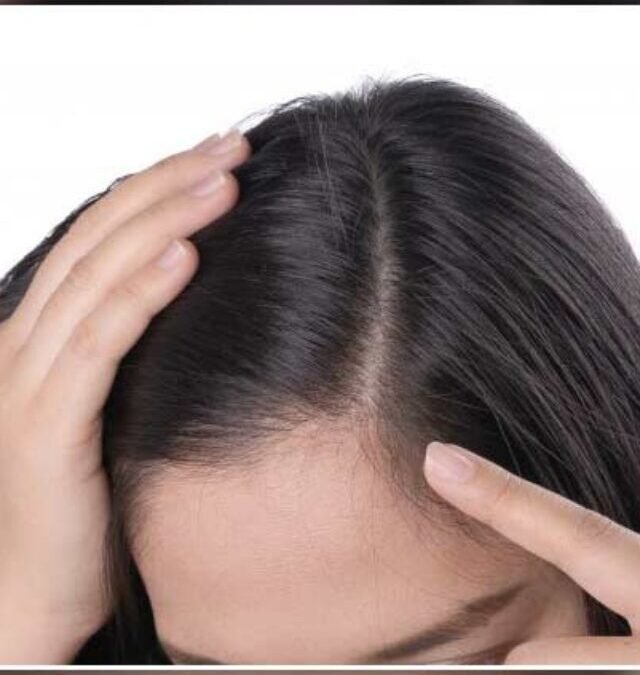 मानसून में फ्रिजी बालों से छुटकारा: घरेलू नुस्खे और उपाय