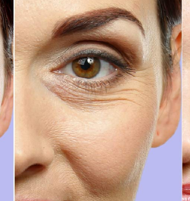 Best Tips to Tighten Sagging Cheeks and Loose Skin