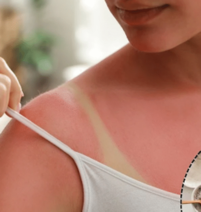 5 Biggest Tanning Myths You Still Believe – Here’s the Truth Behind Them