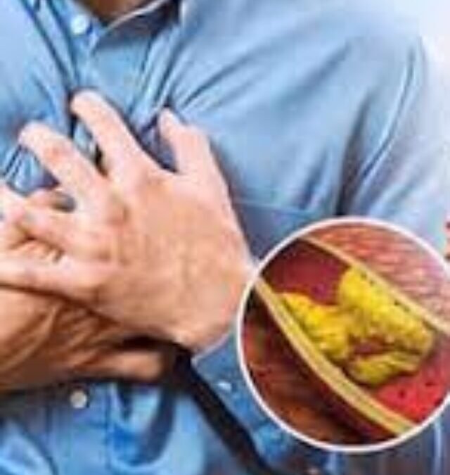 High Cholesterol Warning: 5 Dangerous Signs Your Body Shows First