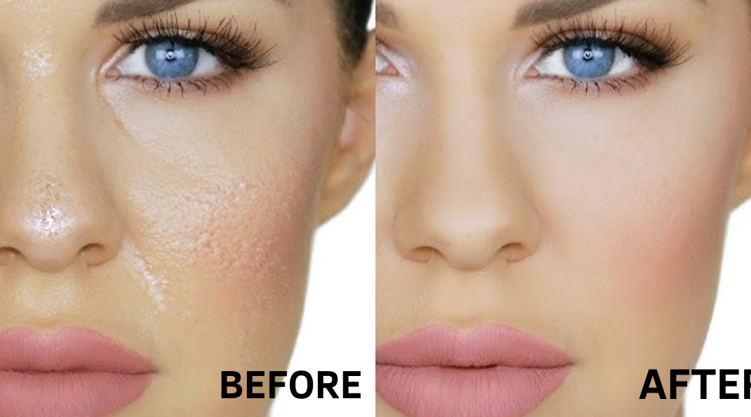 Oily Skin Care Tips for glowing and oil-free face in Hindi