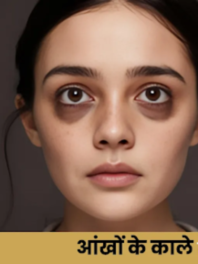 Forget Expensive Parlors! Remove Stubborn Dark Circles with This ₹20 Remedy